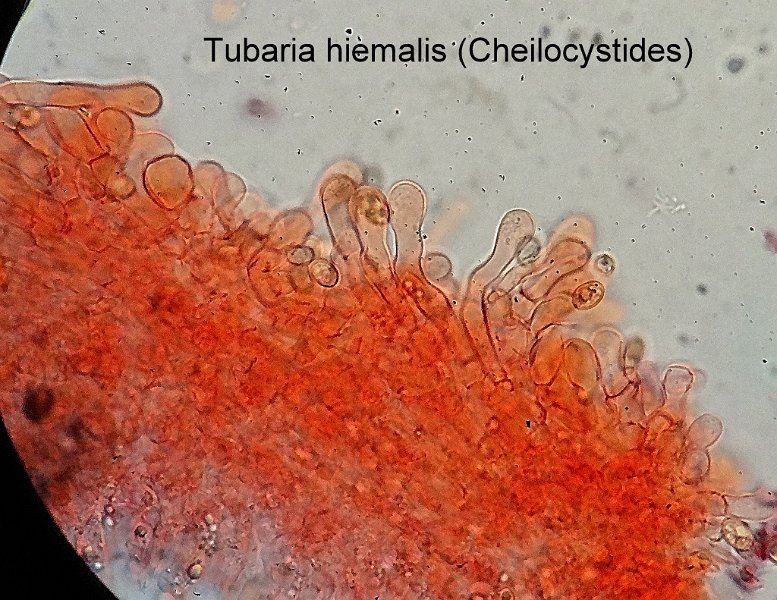 Tubaria hiemalis-amf1906-cheilocystides.jpg